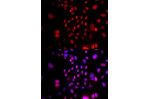 Immunofluorescence analysis of U2OS cells using RFC4 antibody.