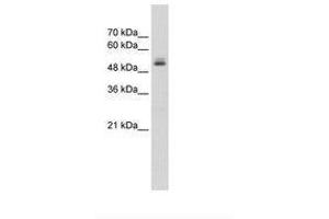 Image no. 1 for anti-Pre-mRNA Processing Factor 19 (PRPF19) (N-Term) antibody (ABIN203526) (PRP19 抗体  (N-Term))