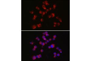 Immunofluorescence analysis of Neuro-2a cells using DCX Rabbit pAb (ABIN7266839) at dilution of 1:150 (40x lens). (Doublecortin 抗体  (AA 240-360))