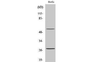 Western Blotting (WB) image for anti-CD69 (CD69) (Internal Region) antibody (ABIN3174275) (CD69 抗体  (Internal Region))
