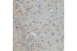 Immunohistochemistry of paraffin-embedded mouse brain using MMP10 antibody (ABIN5971553) at dilution of 1/100 (40x lens). (MMP10 抗体)