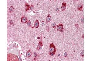 Anti-NR3C2 antibody IHC of human brain, cortex.