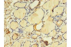 Immunohistochemistry of paraffin-embedded human thyroid tissue using ABIN7172152 at dilution of 1:100 (THRB 抗体  (AA 1-461))