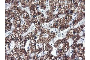 Immunohistochemical staining of paraffin-embedded Human liver tissue using anti-CYP2C9 mouse monoclonal antibody. (CYP2C9 抗体)