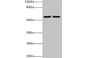 Western blot All lanes: ESR2 antibody at 2 μg/mL Lane 1: Mouse brain tissue Lane 2: PC-3 whole cell lysate Secondary Goat polyclonal to rabbit IgG at 1/10000 dilution Predicted band size: 60, 56, 36, 58, 55, 53, 49, 42, 54 kDa Observed band size: 60 kDa (ESR2 抗体  (AA 2-530))