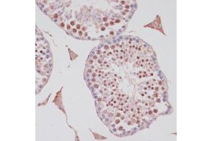 Immunohistochemistry (IHC) image for anti-S100 Calcium Binding Protein P (S100P) (AA 1-95) antibody (ABIN7270133)