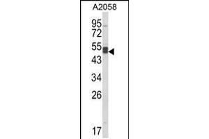 Western blot analysis of AGPAT3 Antibody in A2058 cell line lysates (35ug/lane) (AGPAT3 抗体  (AA 241-269))