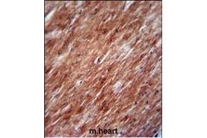IL2 Antibody (Center) (ABIN390899 and ABIN2841106) immunohistochemistry analysis in formalin fixed and paraffin embedded mouse heart tissue followed by peroxidase conjugation of the secondary antibody and DAB staining. (IL-2 抗体  (AA 50-77))
