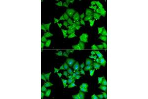 Immunofluorescence analysis of MCF7 cells using  antibody (ABIN6127428, ABIN6136509, ABIN6136511 and ABIN6217463). (Aminoacylase 1 抗体  (AA 1-408))