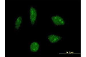 Immunofluorescence of monoclonal antibody to KHSRP on HeLa cell. (KHSRP 抗体  (AA 151-239))