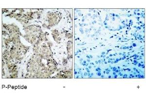 Image no. 1 for anti-Mitogen-Activated Protein Kinase Kinase 6 (MAP2K6) (pSer207) antibody (ABIN196865) (MAP2K6 抗体  (pSer207))
