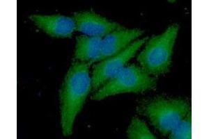 ICC/IF analysis of Frataxin in A549 cell line, stained with DAPI (Blue) for nucleus staining and monoclonal anti-human Frataxin antibody (1:100) with goat anti-mouse IgG-Alexa fluor 488 conjugate (Green). (Frataxin 抗体  (AA 42-210))