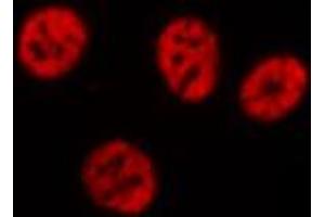 ABIN6274369 staining Hela cells by IF/ICC. (Translin 抗体  (Internal Region))