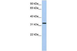 WB Suggested Anti-C12orf24 Antibody Titration: 0. (C12ORF24 抗体  (N-Term))