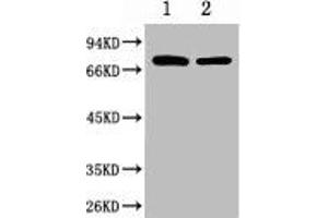 Western blot analysis of 1) Hela, 2) Mouse Brain, diluted at 1:2000.