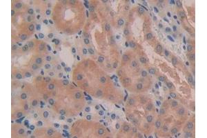 Detection of IL5Ra in Mouse Kidney Tissue using Polyclonal Antibody to Interleukin 5 Receptor Alpha (IL5Ra) (IL5RA 抗体  (AA 41-203))