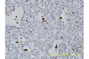 Image no. 3 for anti-Phospholipid Transfer Protein (PLTP) (AA 1-422) antibody (ABIN466078) (PLTP 抗体  (AA 1-422))