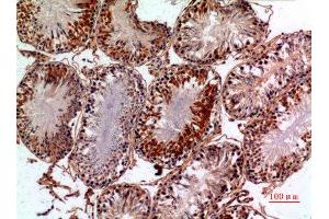 Immunohistochemistry (IHC) analysis of paraffin-embedded Rat Testis, antibody was diluted at 1:100. (PNPLA6 抗体  (Internal Region))