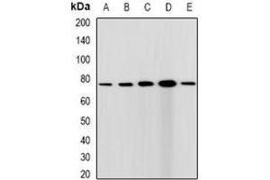 Western blot analysis of CGBP expression in HepG2 (A), Hela (B), A431 (C), mouse spleen (D), rat testis (E) whole cell lysates. (CXXC1 抗体)