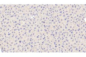 Detection of CAT in Mouse Liver Tissue using Polyclonal Antibody to Catalase (CAT) (Catalase 抗体  (AA 80-239))