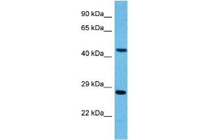 Host:  Mouse  Target Name:  PYGO2  Sample Tissue:  Mouse Pancreas  Antibody Dilution:  1ug/ml (PYGO2 抗体  (N-Term))