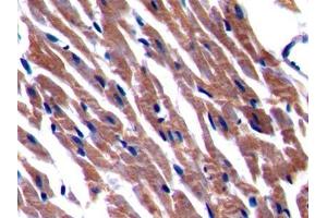 IHC-P analysis of Rat Cardiac Muscle Tissue, with DAB staining. (BACE2 抗体  (AA 242-502))