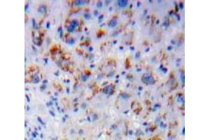 Used in DAB staining on fromalin fixed paraffin-embedded Liver tissue (IL7R 抗体  (AA 48-217))