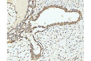 IHC analysis of RPL29 using anti-RPL29 antibody (ABIN7600993). (RPL29 抗体  (AA 27-153))