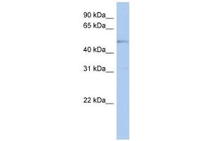 TBC1D10C antibody used at 1 ug/ml to detect target protein. (Carabin 抗体  (N-Term))