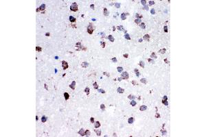 Anti-Cytochrome C antibody, IHC(P) IHC(P): Rat Lung Tissue (Cytochrome C 抗体  (C-Term))
