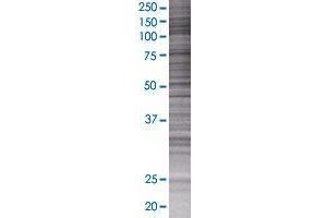 NLGN1 transfected lysate. (NLGN1 293T Cell Transient Overexpression Lysate(Denatured))