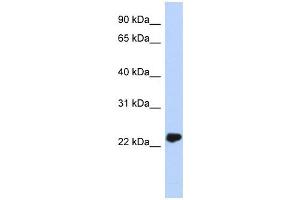 UCHL3 antibody used at 1 ug/ml to detect target protein. (UCHL3 抗体)