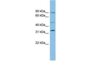 Image no. 1 for anti-Fatty Acid Transport Protein 3 (FATP3) (AA 503-552) antibody (ABIN6744761) (SLC27A3 抗体  (AA 503-552))