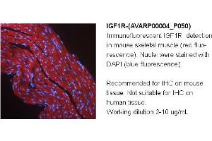 Image no. 1 for anti-Insulin-Like Growth Factor 1 Receptor (IGF1R) (Middle Region) antibody (ABIN504556) (IGF1R 抗体  (Middle Region))
