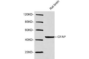 Western blot analysis of lysates using Rabbit Anti-GFAP Polyclonal Antibody (ABIN398827, 1 µg/mL) The signal was developed with IRDye-800 Conjugated Goat Anti-Rabbit IgG. (GFAP 抗体  (AA 250-300))
