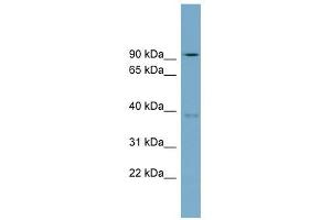 RTDR1 antibody used at 1 ug/ml to detect target protein. (RTDR1 抗体  (N-Term))