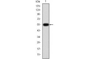 Western blot analysis of TGF β Receptor I expression in HepG2 cells (TGFBR1 抗体  (Internal Region))