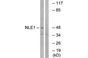 Western blot analysis of extracts from COS cells, using NLE1 Antibody. (NLE1 抗体  (AA 301-350))