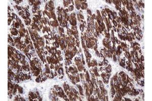 Immunohistochemistry (IHC) image for anti-Amylase, alpha 2B (Pancreatic) (AMY2B) antibody (ABIN2715975)