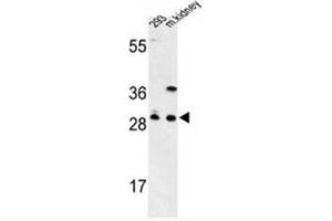 Western blot analysis of GCLM / GLCLR Antibody (C-term) in 293 cell line and mouse kidney tissue lysates (35ug/lane). (GCLM 抗体  (C-Term))
