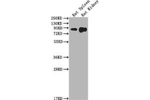 Western Blot Positive WB detected in: Rat Spleen tissue, Rat Kidney tissue All lanes: Ace2 antibody at 1:2000 Secondary Goat polyclonal to rabbit IgG at 1/50000 dilution Predicted band size: 93 kDa Observed band size: 93 kDa (ACE2 抗体  (AA 105-118))
