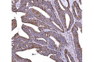 IHC analysis of COX6B1 using anti-COX6B1 antibody (ABIN7603206).