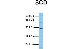 Host:  Rabbit  Target Name:  SCD  Sample Tissue:  Human Jurkat  Antibody Dilution:  1. (SCD 抗体  (Middle Region))