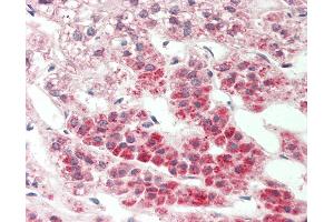 Immunohistochemistry (IHC) image for anti-Nuclear Receptor Subfamily 4, Group A, Member 3 (NR4A3) (AA 351-400) antibody (ABIN2626156)