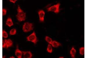 Immunofluorescence (fixed cells) (IF/ICC) image for anti-Olfactory Receptor, Family 4, Subfamily Q, Member 3 (OR4Q3) (C-Term) antibody (ABIN6263869)