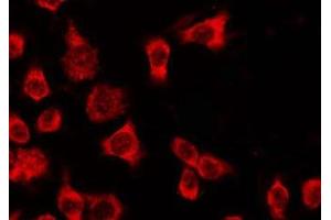 ABIN6278611 staining HeLa by IF/ICC. (OR4Q3 抗体  (C-Term))