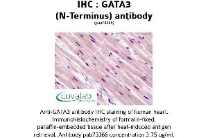 Image no. 1 for anti-GATA Binding Protein 3 (GATA3) (N-Term) antibody (ABIN1734640) (GATA3 抗体  (N-Term))