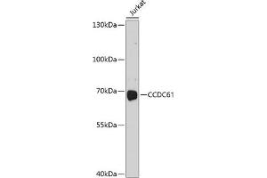 Western blot analysis of extracts of Jurkat cells, using CCDC61 antibody (ABIN6133303, ABIN6138042, ABIN6138043 and ABIN6214563) at 1:1000 dilution. (CCDC61 抗体  (AA 352-531))