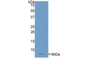 Detection of Recombinant C4BPa, Human using Polyclonal Antibody to C4 Binding Protein Alpha (C4BPa) (C4BPA 抗体  (AA 548-597))