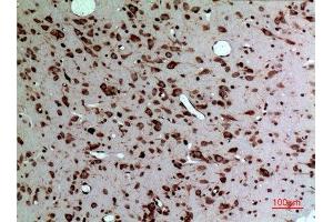 Immunohistochemistry (IHC) analysis of paraffin-embedded Rat Brain, antibody was diluted at 1:100. (Midkine 抗体  (Internal Region))